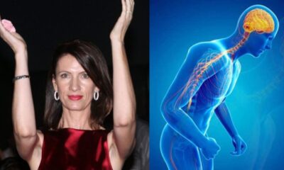 kili-sfakianaki-ti-einai-i-nosos-parkinson-apo-tin-opoia-pethane-kai-poia-ta-simptomata-2 (1)