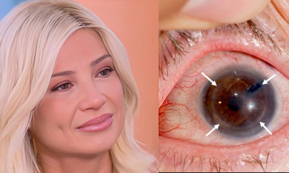 faii-skorda-ti-einai-o-keratokonos-me-ton