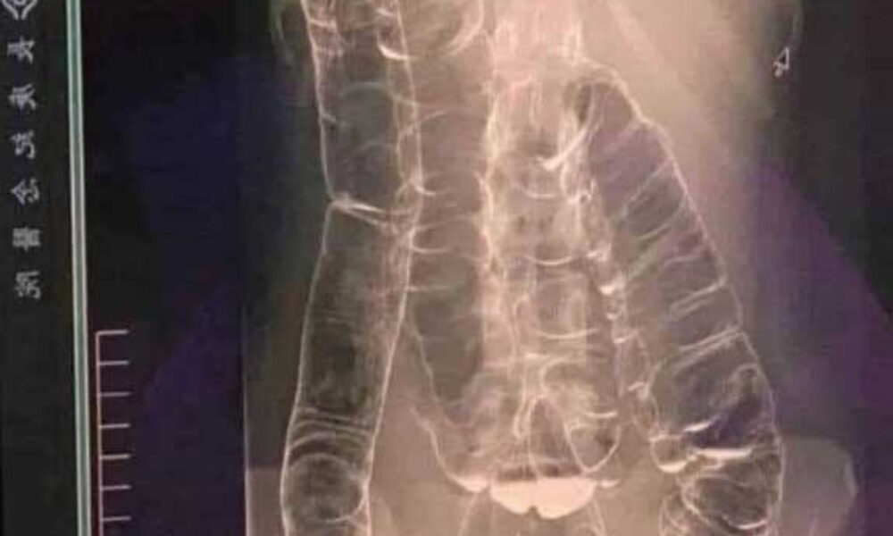 587861692_1148759040760062_1821849608579294216_n