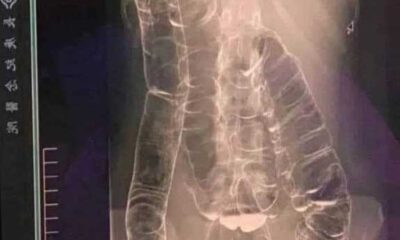 587861692_1148759040760062_1821849608579294216_n