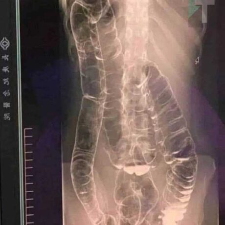 587861692_1148759040760062_1821849608579294216_n