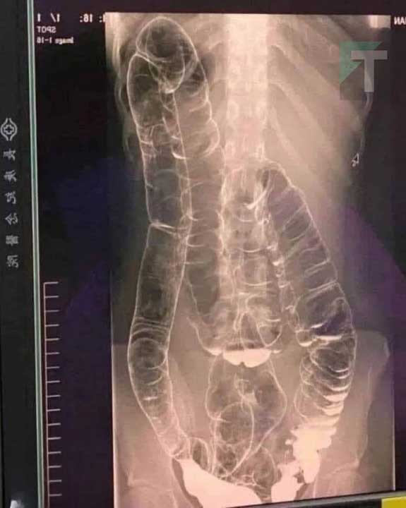 587861692_1148759040760062_1821849608579294216_n