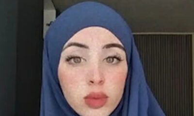 amsterntam-edesan-fimosan-kai-petaxan-se-valto-18chroni