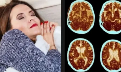 mesimerianos-ypnos-to-athoo-simadi-pou-apotelei-proangelo-tou-altschaimer-kai-oi-perissoteroi-agnooun