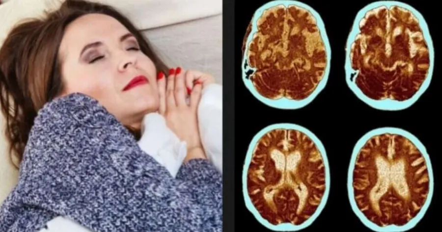 mesimerianos-ypnos-to-athoo-simadi-pou-apotelei-proangelo-tou-altschaimer-kai-oi-perissoteroi-agnooun