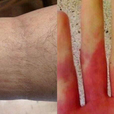 anakopi-kardias-6-proeidopoiitika-simadia