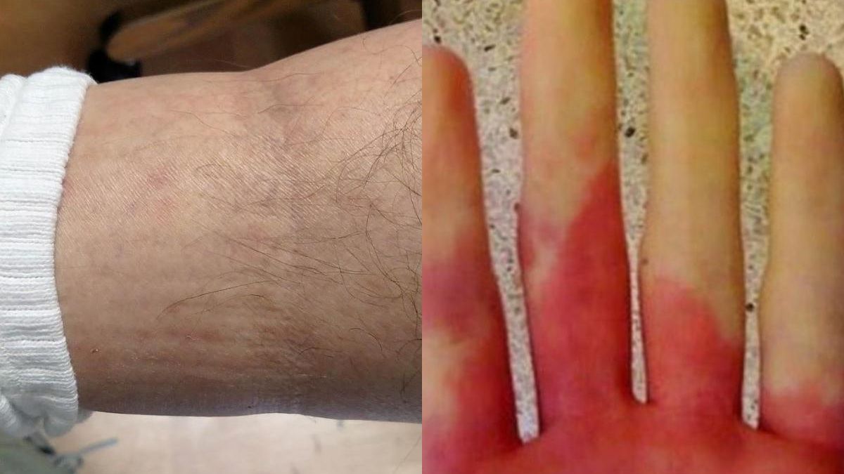 anakopi-kardias-6-proeidopoiitika-simadia