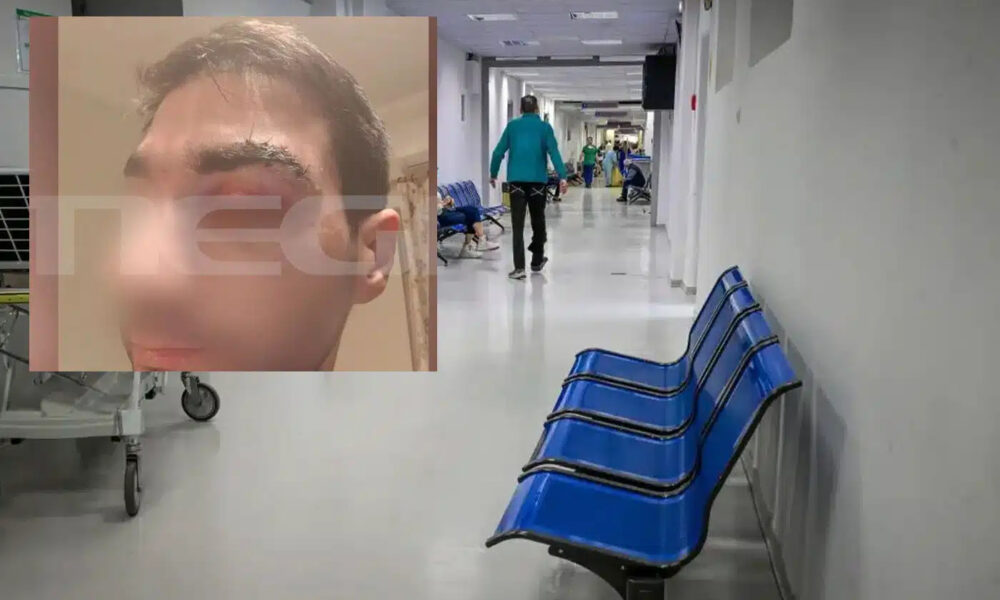 aigio-pethane-o-43chronos-asthenis-boxer-pou-gronthokopise