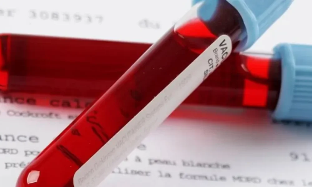 pote-i-geniki-aimatos-deichnei-karkino