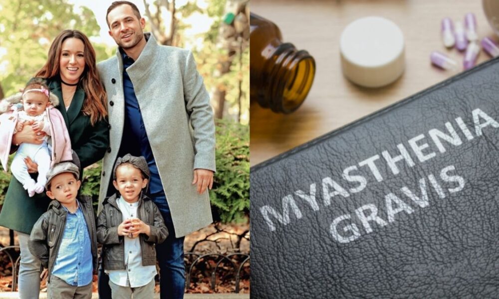 myasthenia-gravis (1)