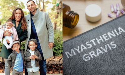 myasthenia-gravis (1)