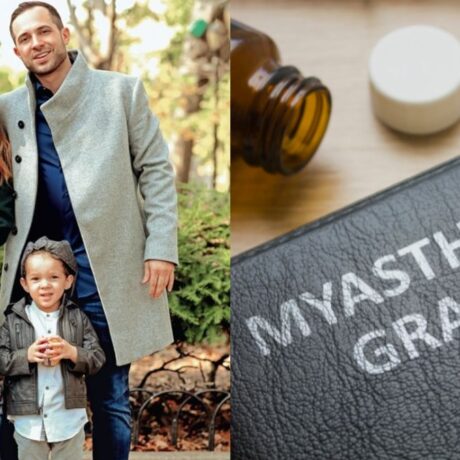 myasthenia-gravis (1)