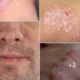 psoriasi-oi-6-trofes-pou-borei-na-epideinonoun-e1784607599664_